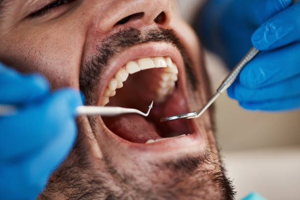 Best Emergency Dentist Near Me  in Forsgate, NJ